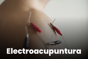 Electroacupuntura