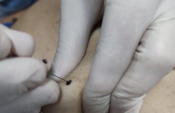 Procedimientos_Acutomo_07