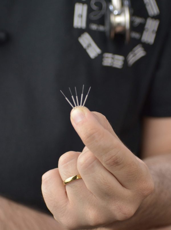 Procedimientos_Auriculoterapia_02