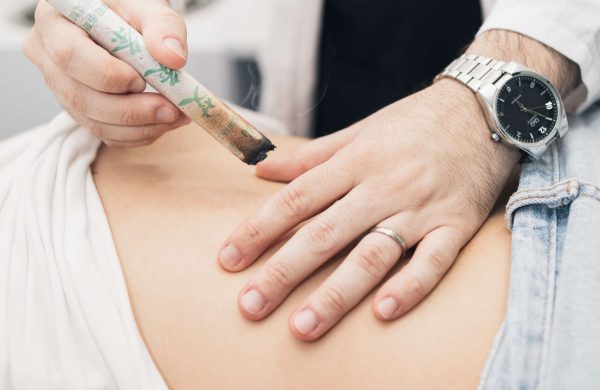 Procedimientos_Moxibustion_03