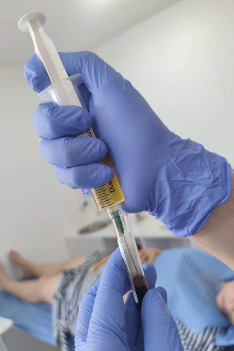 Procedimientos_Plasma_04