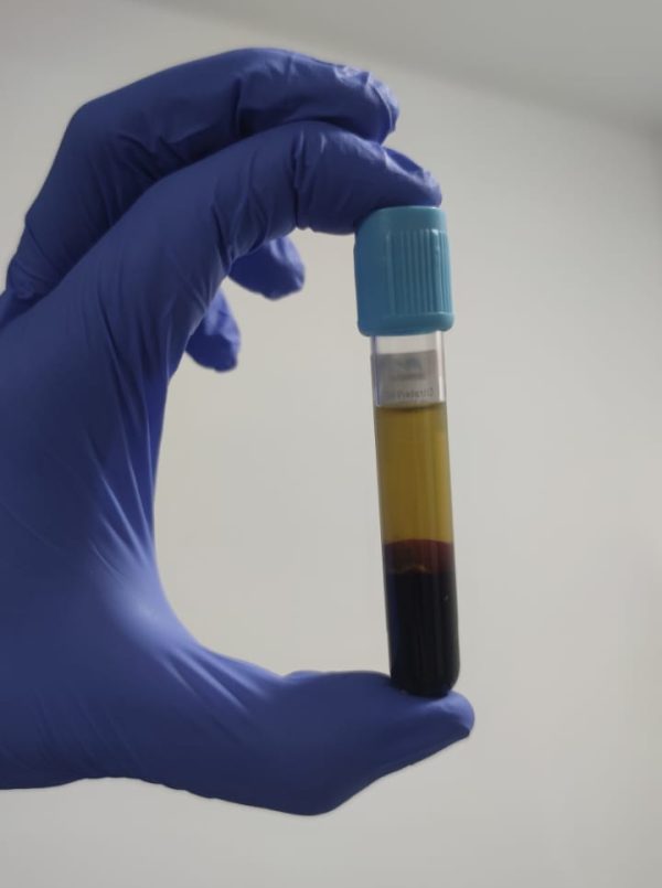 Procedimientos_Plasma_05